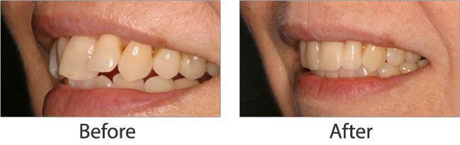 Cosmetic dentistry before and after 05