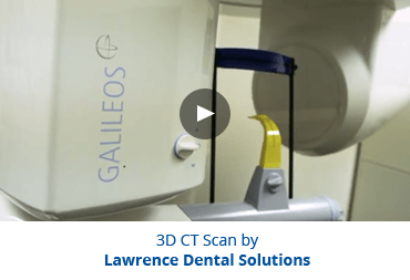 best technology 3d Sacn introduction by Lawrence Dental Solutions  near Lawrence, KS